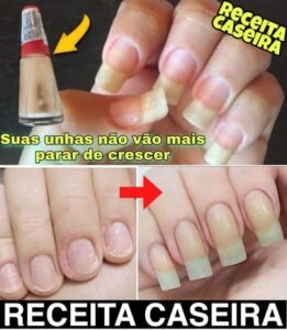 Dica caseira para ter unhas grandes e resistentes com apenas 3 ingredientes